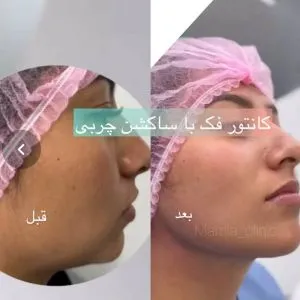 کلینیک زیبایی مامیا