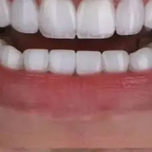 دندانپزشکی پرلین