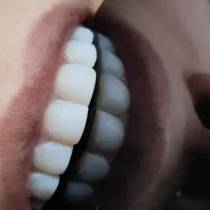 پزشک ،سلامت،وزیبایی دندان