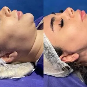 پزشک جراح سوپرکانتورتیگ