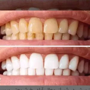 خدمات دندانپزشکی و دندانسازی مروارید