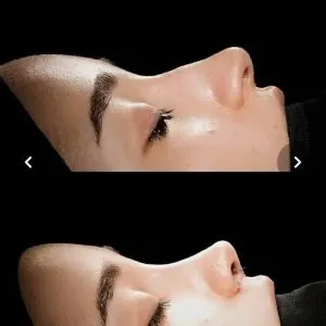 جراح زیبایی دکتر امیرحسین علویان