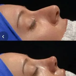 متخصص گوش و حلق وبینی دکتر علی رضا بختیاری