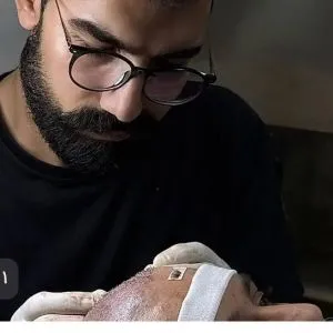 کاشت مو در کلینیک تخصصی تبریز
