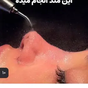 کلینیک جراحی وزیبایی عمل بینی