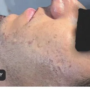 کلینیک تخصصی ترمیم جوش و زخم