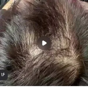 کلینیک تخصصی مو،نورااویس