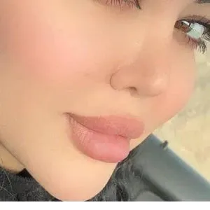 کلینیک کاشت مووابرورویال