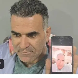 کلینیک کاشت مو