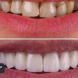 خدمات دندانپزشکی