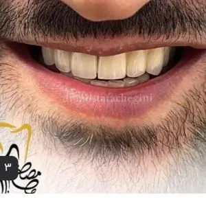 خدمات دندانپزشکی دکتر مصطفی چگینی